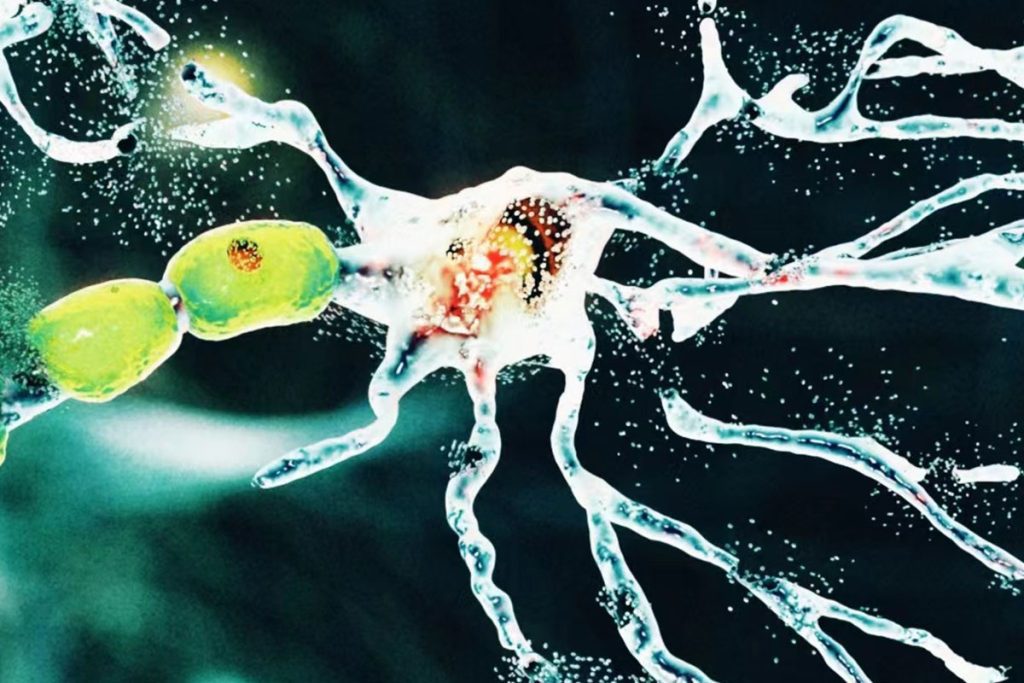 AI-discovered drug for ALS enters clinical trials