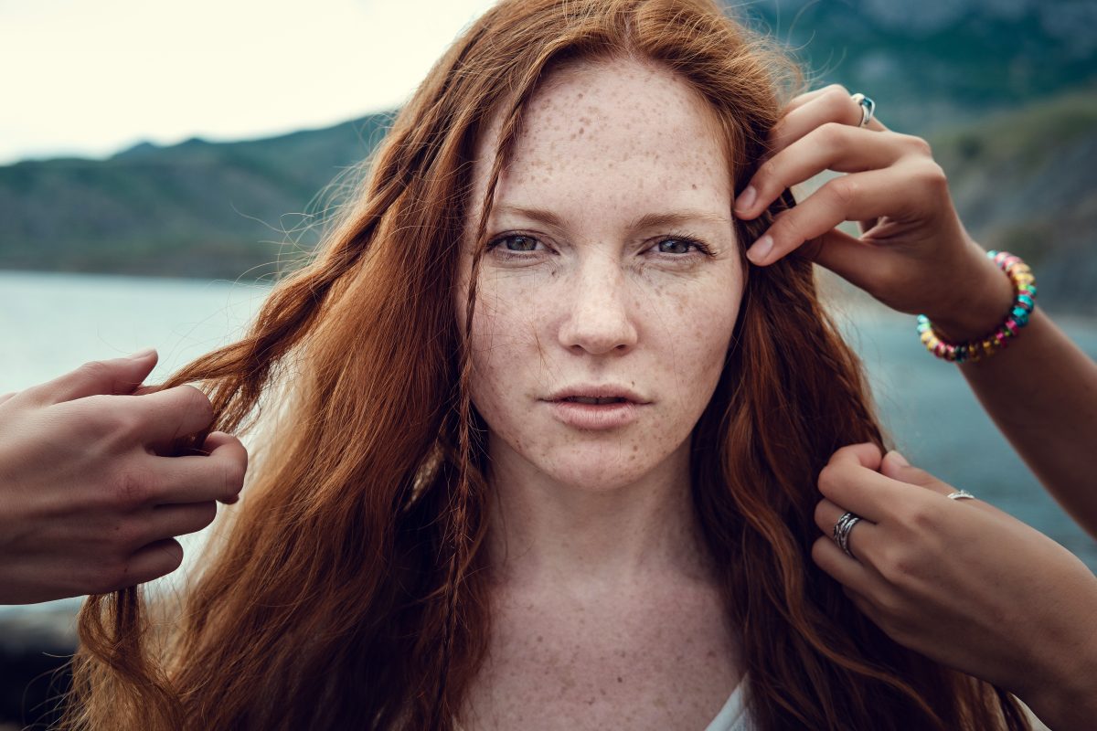 What causes people to have freckles?